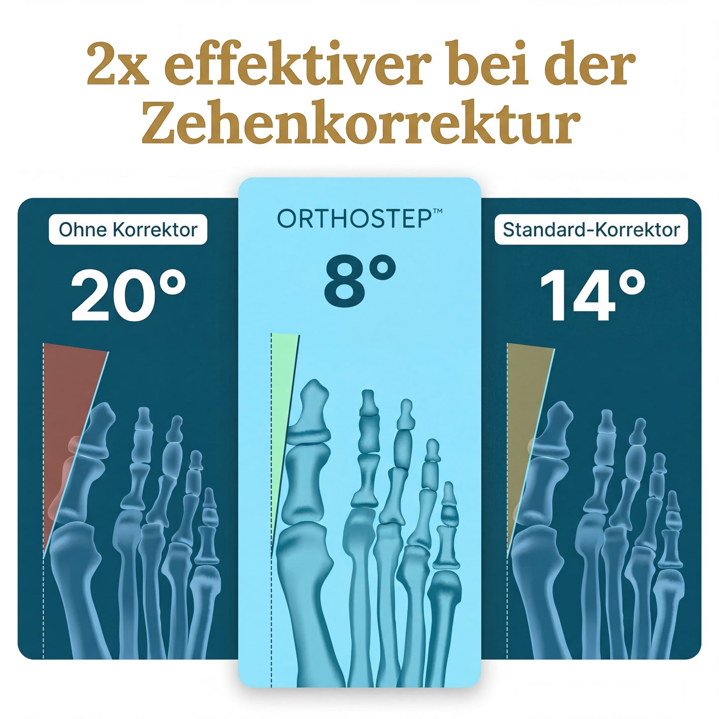OrthoStep™ Hallux-Schiene